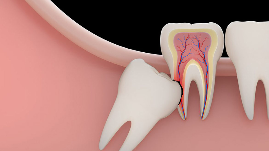 Dentalia smiles